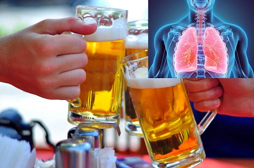 Rượu bia là nguyên nhân dẫn đến viêm, nhiễm trùng phổi